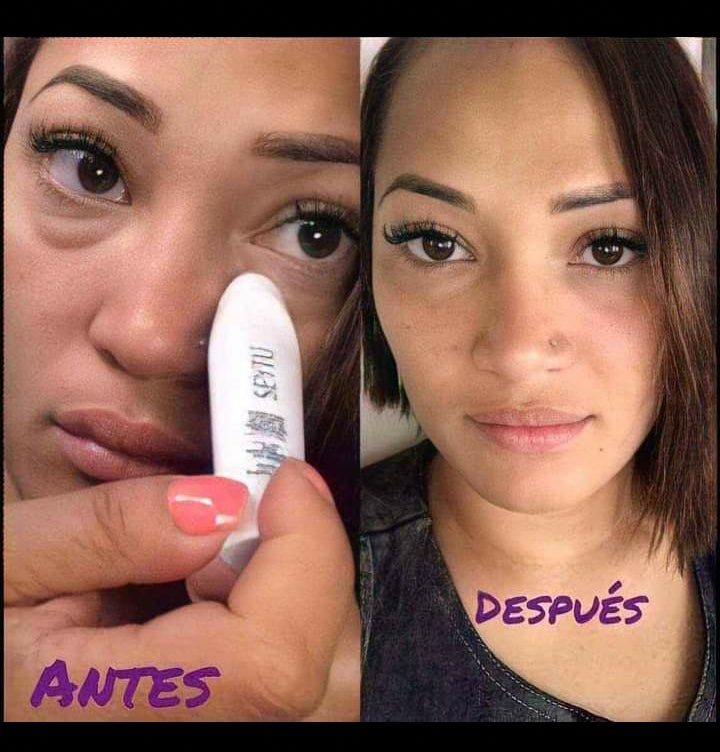 suero contorno de ojos